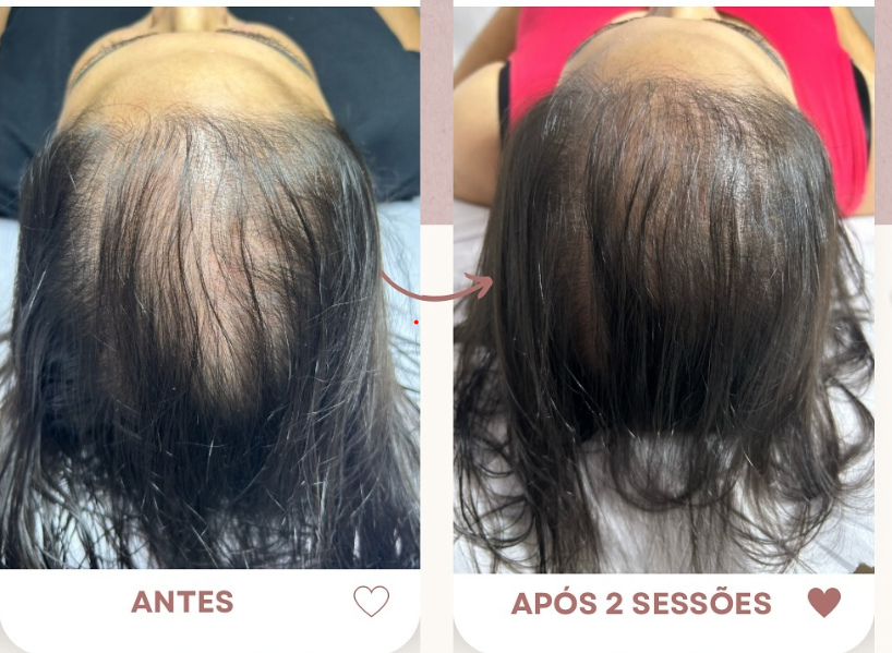 Depoimento de cliente 4